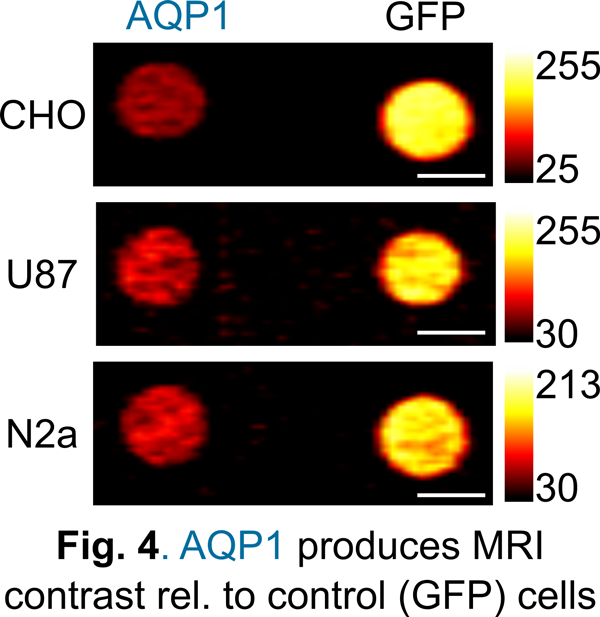 AQP1 produces MRI contrast rel. to control (GFP) cells