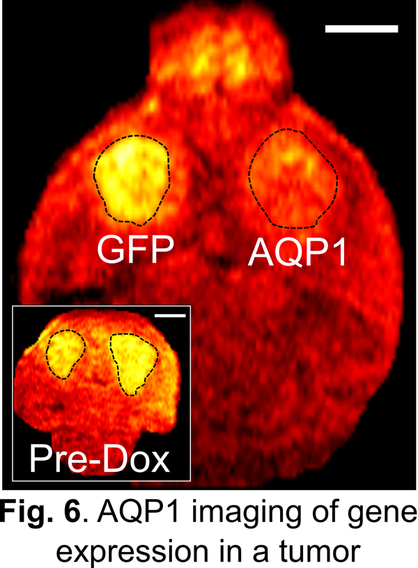 AQP1 imaging of gene expression in a tumor